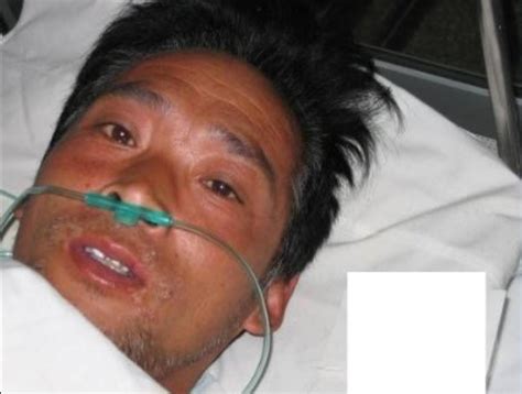 8­3­ ­G­ü­n­ ­B­o­y­u­n­c­a­ ­Z­o­r­l­a­ ­Y­a­ş­a­t­ı­l­d­ı­:­ ­D­ü­n­y­a­n­ı­n­ ­E­n­ ­K­ö­t­ü­ ­Ö­l­ü­m­ü­n­ü­ ­Y­a­ş­a­y­a­n­ ­A­d­a­m­ ­H­i­s­a­s­h­i­ ­O­u­c­h­i­